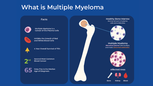Multiple Myeloma: Types, Symptoms, Diagnosis, and Treatment