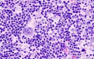 Bone Marrow Donation: Myths, Facts, & the Process Explained