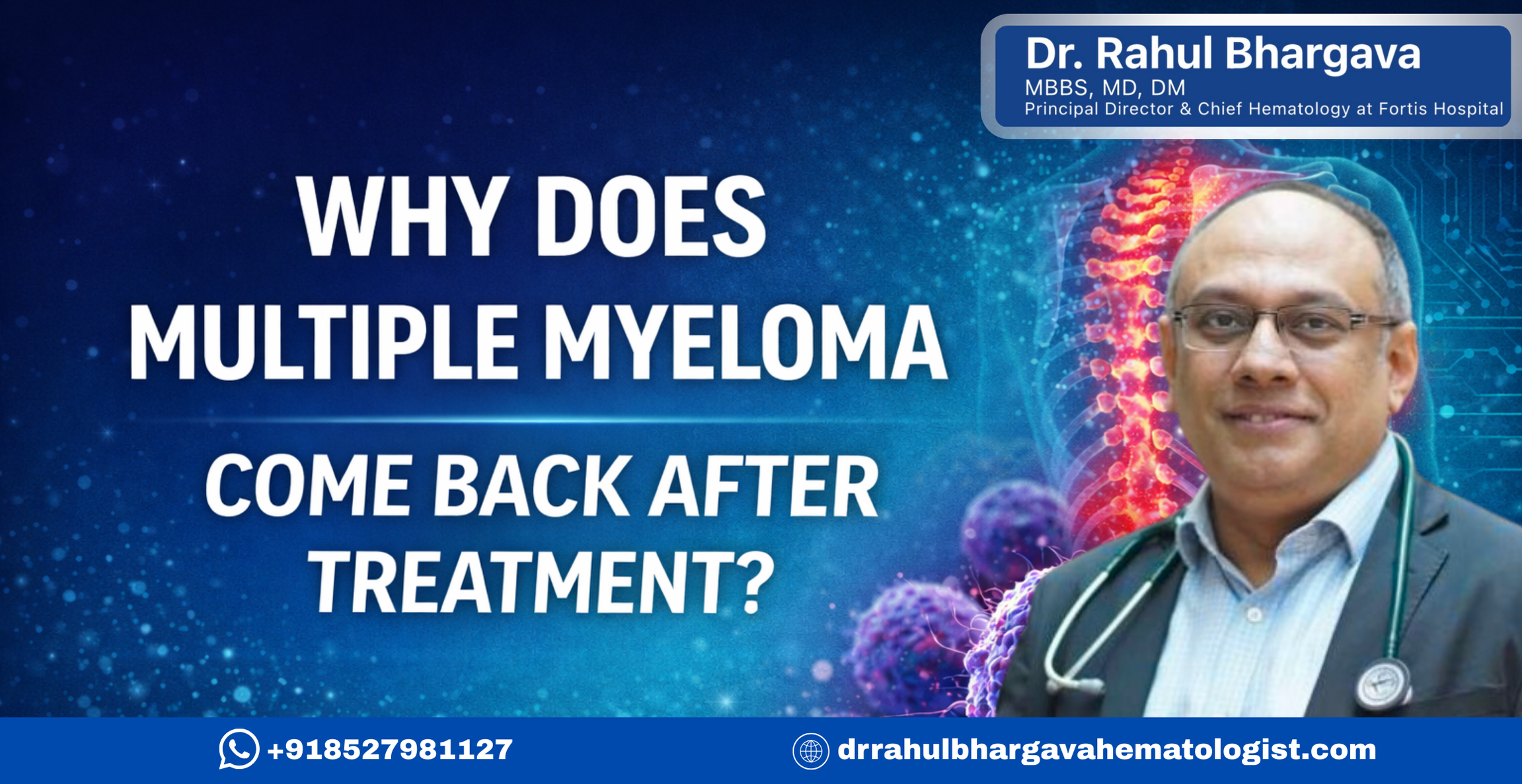 Why Does Multiple Myeloma Come Back After Treatment?
