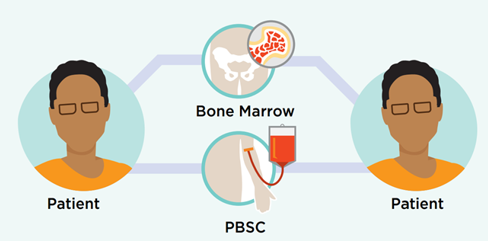 Autologous Bone Marrow Transplant (ABMT) Cost in India