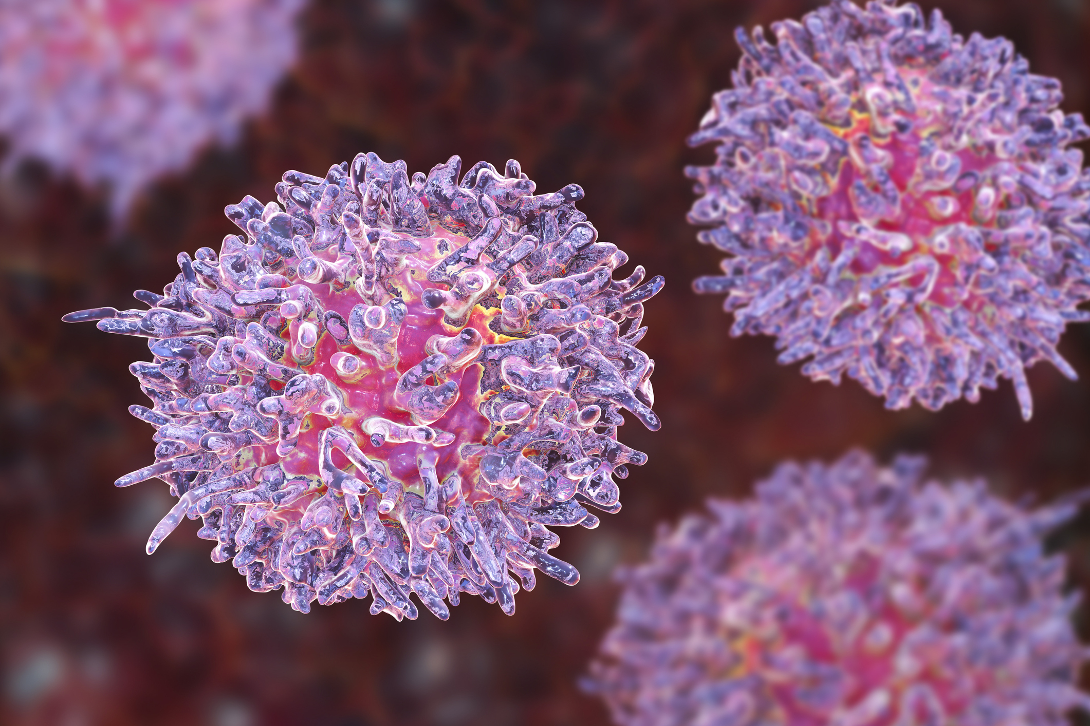 Hairy Cell Leukemia (HCL) Treatment Cost in India