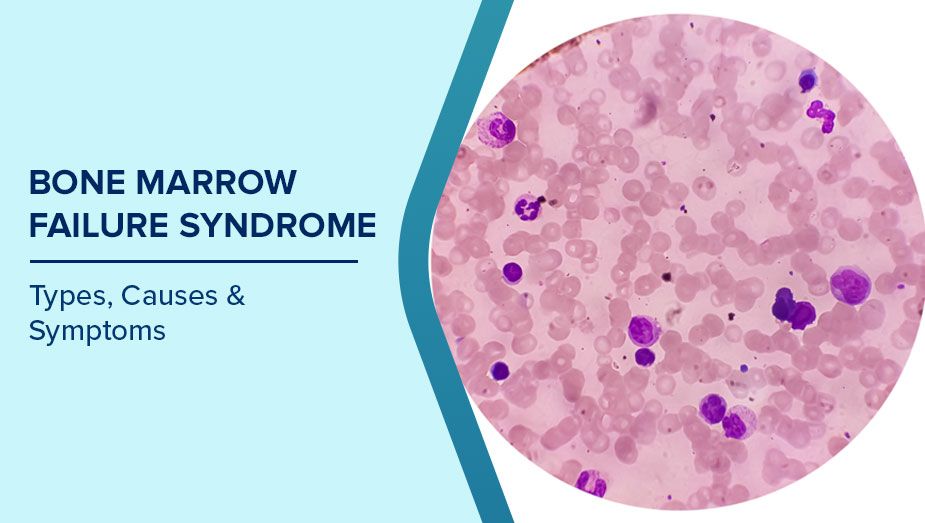 Bone Marrow Failure Syndromes (BMFS) Treatment in India