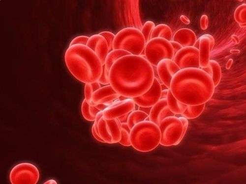 Hypercoagulable Disorder