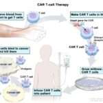 Car t Cell